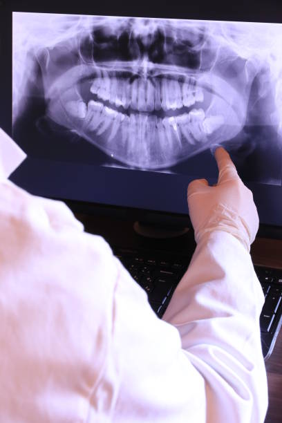 Best Emergency Dental Care for Broken or Chipped Teeth in Buckhannon, WV