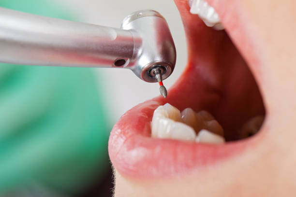 Best Emergency Orthodontic Services in Buckhannon, WV
